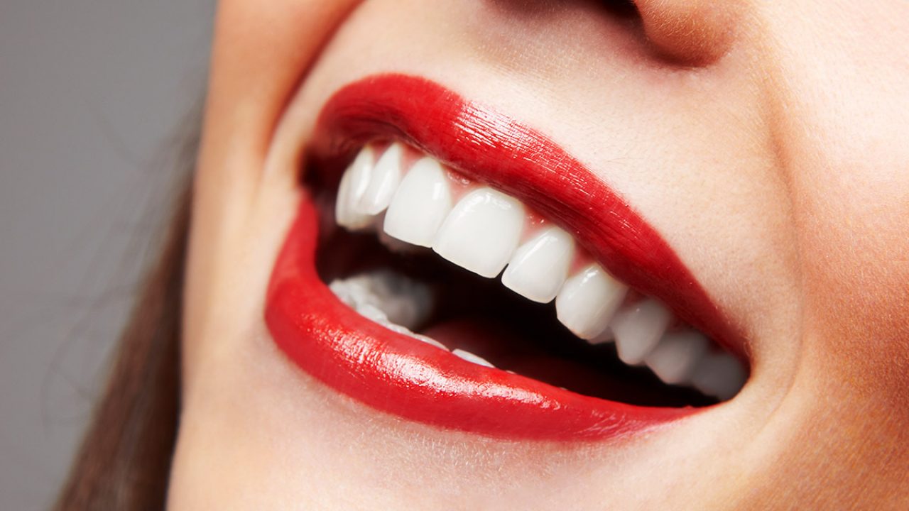 Dental Veneers Is Solution to a Perfect Smile