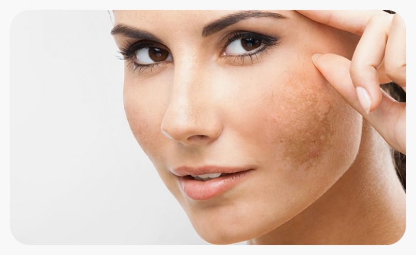 https://www.northstardermatology.com/southlake/chemical-peels/